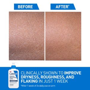 CeraVe Intensive Moisturizing Lotion 12oz bottle with 5% Hydro-Urea